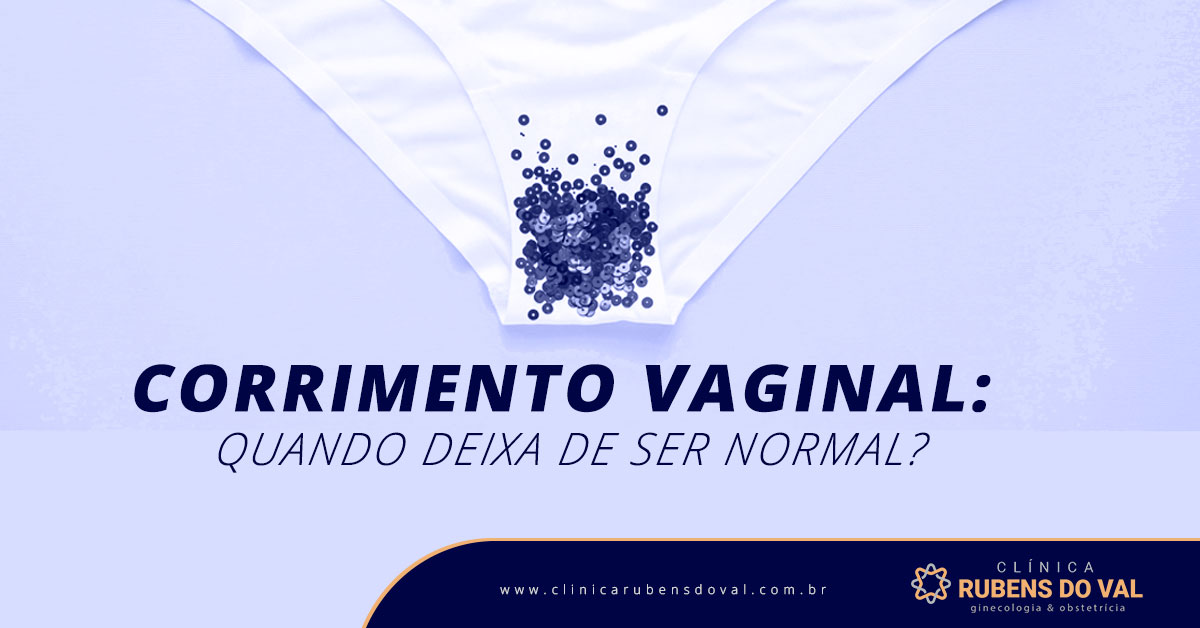 Corrimento Vaginal O Que é E Sintomas Clínica Rubens Do Val Crm 58764 1967