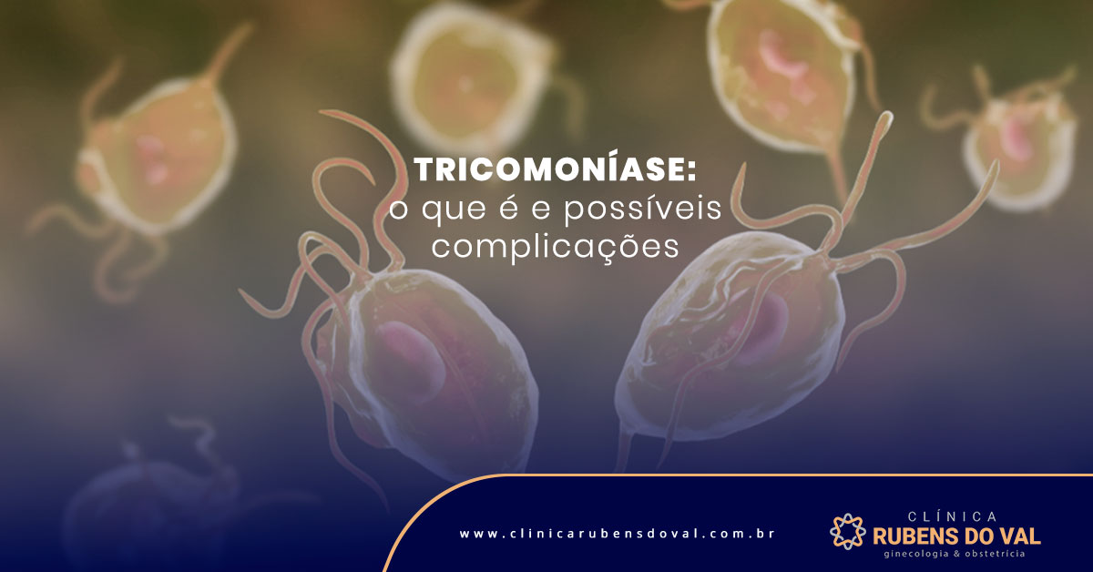 O Que é Tricomoniase - FDPLEARN