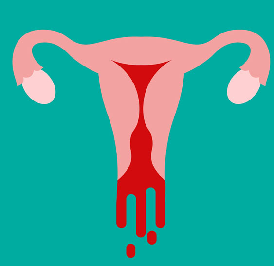 O que é um ciclo menstrual “irregular”?