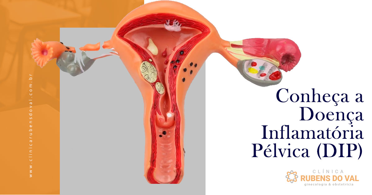 Ciclo menstrual irregular? Descubra o que pode causar o problema - Clínica  Rubens do Val CRM 58764