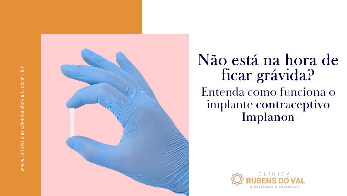 nao esta na hora de ficar gravida entenda como funciona o implante contraceptivo implanon bg