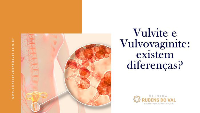 Odor Vaginal: quando é normal e quando é preocupante? Entenda! - Clínica  Rubens do Val CRM 58764