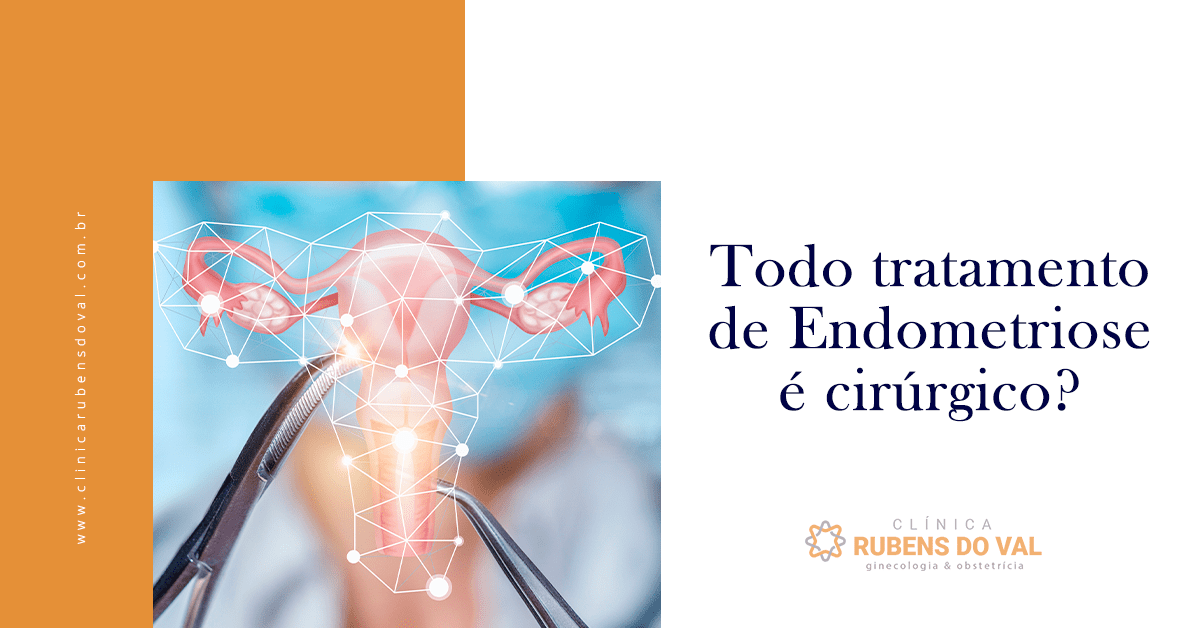 Todo tratamento de Endometriose é cirúrgico Clínica Rubens do Val CRM