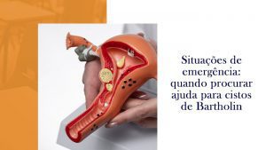 Situações de emergência: quando procurar ajuda para cistos de Bartholin ...