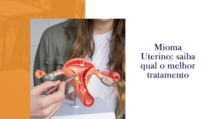 Médico usando um modelo anatômico do útero para explicar a uma paciente questões relacionadas à saúde feminina, como miomas, em uma consulta ginecológica.