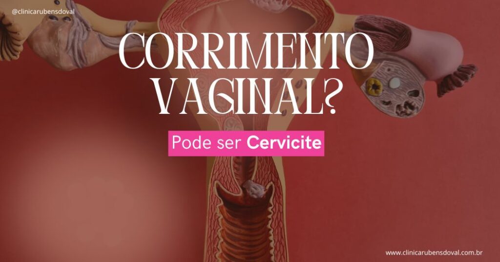 Modelo anatômico de útero em fundo vermelho, mostrando estrutura interna e representação de condições ginecológicas.