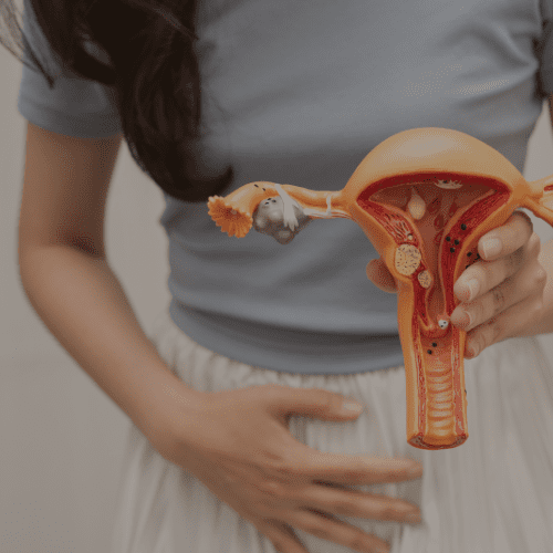 Mulher segurando modelo anatômico do útero, ilustrando lesão pré-cancerosa no colo do útero e cuidados ginecológicos.