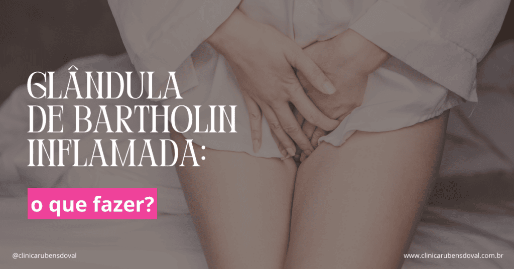 Glândula de Bartholin inflamada: o que fazer? 1 Arte sobre glândula de Bartholin inflamada